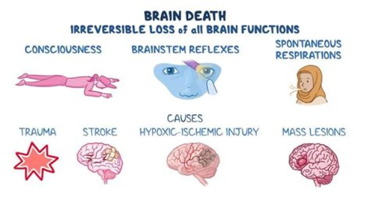 Can a brain be kept alive after death?