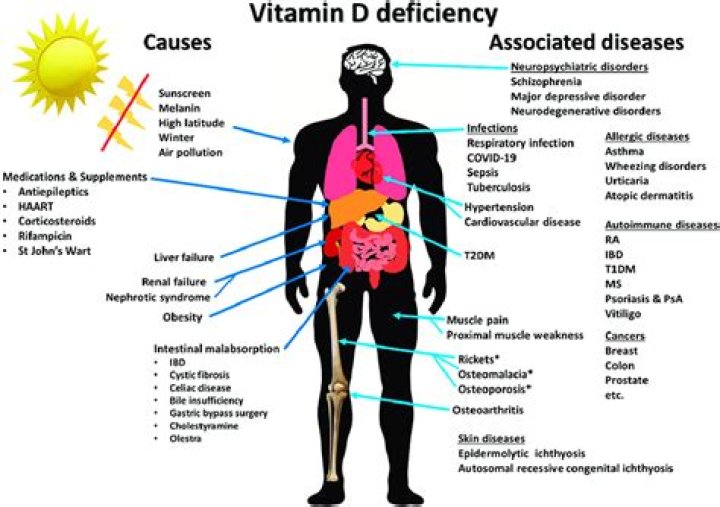 Can vitamin D deficiency cause nerves?