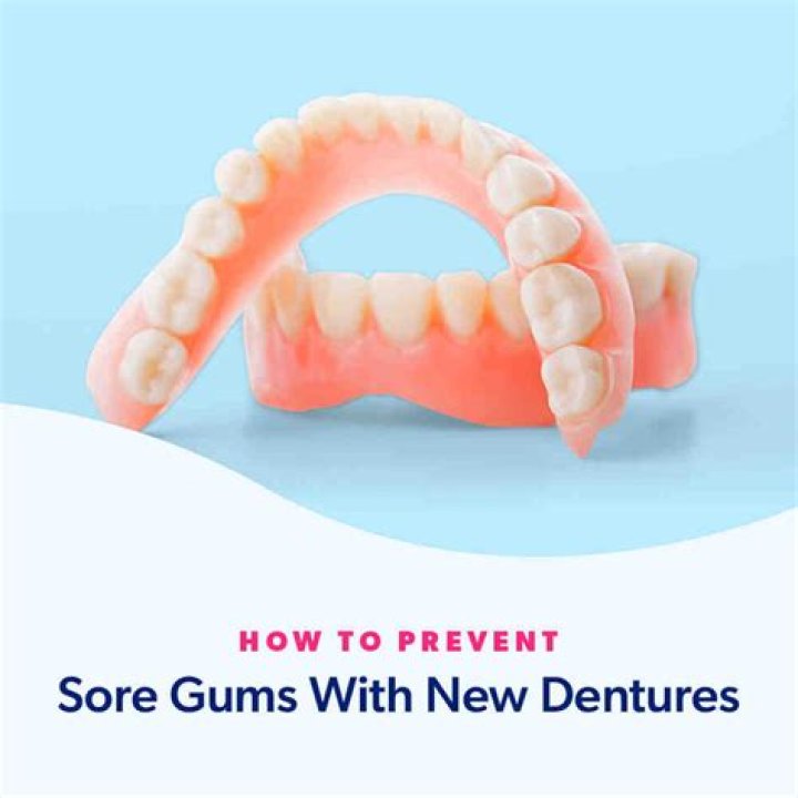 How long does it take gums to heal for dentures?