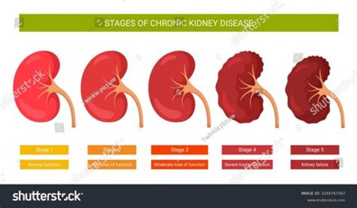 Is there a Stage 6 kidney failure?