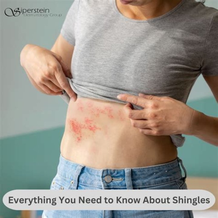 Who should not be around someone with shingles?